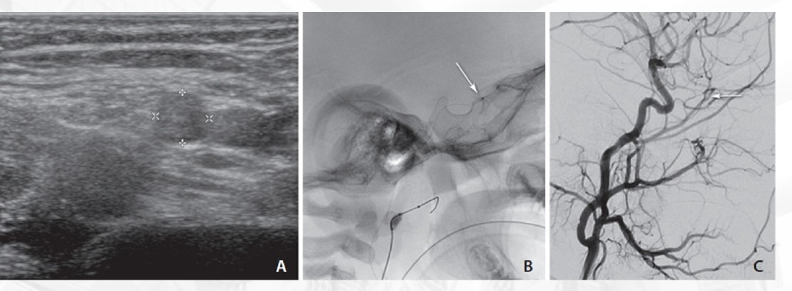 Ultrasound, fluoroscopic and angiographic views